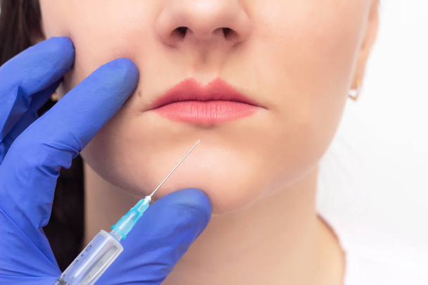 doctor cosmetologist conducts a procedure to increase the volume of women's lips with the help of injection of hyaluronic acid - Φωτογραφία, εικόνα