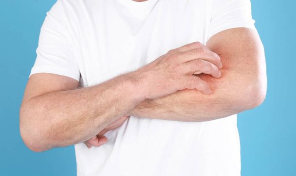 Senior man scratching forearm on color background, closeup. Allergy symptom - Fotografie, Obrázek