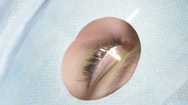 chirurgii laserowej oka - Materiał filmowy, wideo