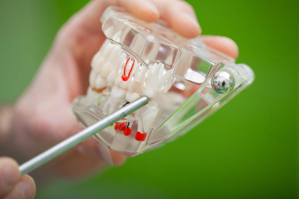 Dentista sostén de la mano del modelo de mandíbula de los dientes y limpieza dental con herramienta dental
 - Foto, Imagen