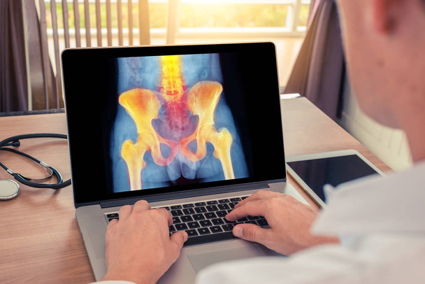 Doktor kalça ve omurgada ağrı nın röntgenini izliyor. Radyoloji kavramı - Fotoğraf, Görsel