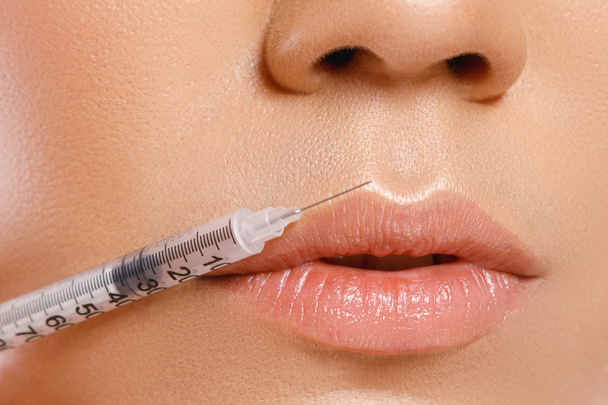 Lábios femininos e seringa com enchimento
 - Foto, Imagem