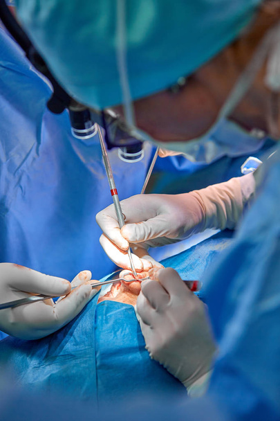 Хирург и его ассистент проводят косметическую операцию на носу в операционной больницы. Изменение формы носа, увеличение. Ринопластика
. - Фото, изображение