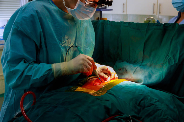 Lekarz robi pracę serca w szpitalu chirurgicznym dla krążenia awaryjnego centrum chirurgii. - Zdjęcie, obraz