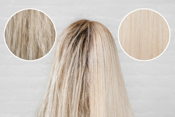 Больной, стриженный и здоровый кератин для волос. До и после лечения перхоти
 - Фото, изображение