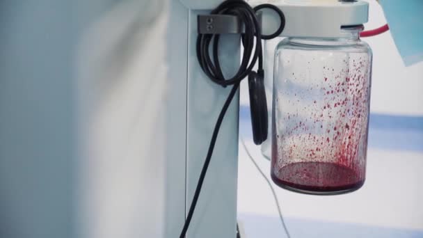 během provozu proudí červená krev do nádoby v operačním sále - Záběry, video