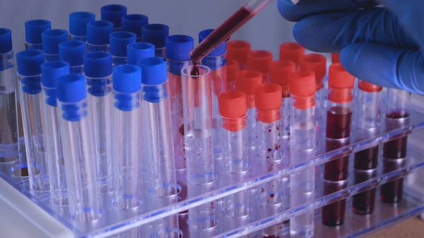 Laborarbeit, der Arzt hält eine Spritze, eine medizinische Maske und eine Brille, nimmt einen Test aus einem Reagenzglas in blauen Gummihandschuhen, Analyse, Blut, dna, ein Reagenzglashalter. - Foto, Bild