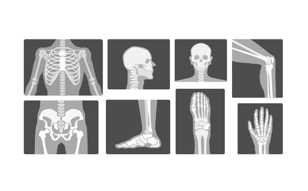 Kreatív radiológia csontváz Bones Vector reális X-ray logo design illusztráció - Vektor, kép