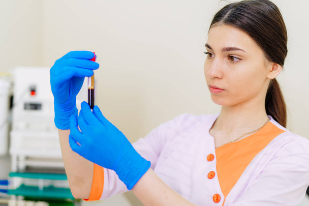 Blood sample. Lab technician holding blood tube sample for study - Foto, imagen