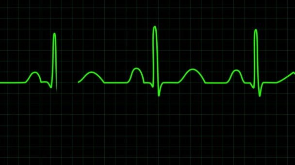 Ηλεκτροκαρδιογράφημα οθόνη 2D κινούμενα σχέδια καρδιακός παλμός  - Πλάνα, βίντεο