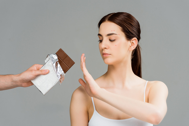 cropped view of man holding chocolate bar near brunette woman with acne isolated on grey  - Foto, Imagem