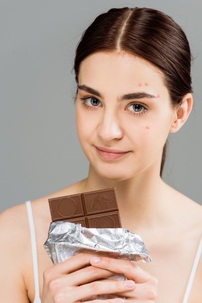 young brunette woman with acne on face holding chocolate bar isolated on grey  - Valokuva, kuva