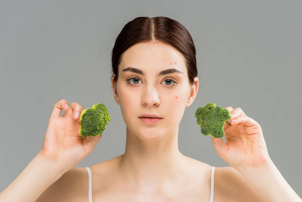 young brunette woman with acne on face holding broccoli isolated on grey  - Photo, Image