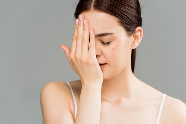 giovane donna con acne che copre il viso con mano isolata su grigio
  - Foto, immagini