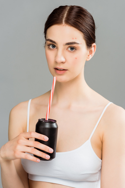 young woman with acne on face holding can with straw isolated on grey - Foto, imagen
