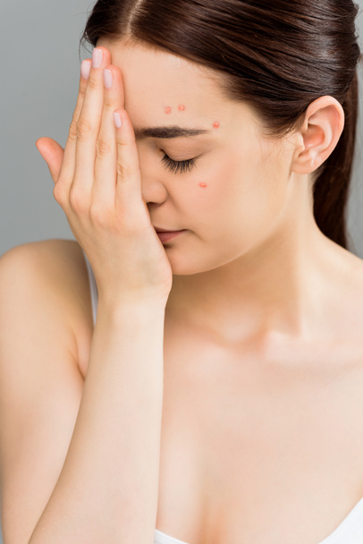 young woman with closed eyes and acne covering face with hand isolated on grey  - 写真・画像