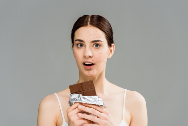 mujer morena sorprendida con acné en la cara sosteniendo barra de chocolate aislado en gris
  - Foto, Imagen