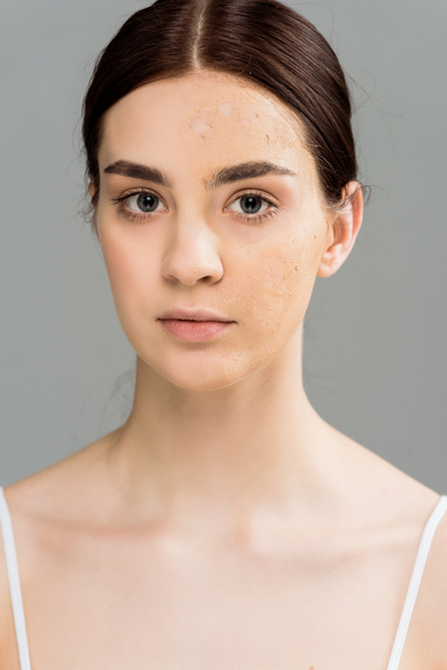 brunette young woman with problem skin looking at camera isolated on grey  - Photo, image