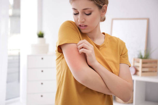 Woman scratching arm indoors, space for text. Allergy symptoms - Φωτογραφία, εικόνα
