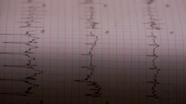 Badanie elektrokardiograficzne impulsy krążenia ludzkiego serca - Materiał filmowy, wideo