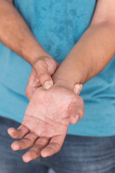 Mann leidet an Handgelenkschmerzen, Karpaltunnelsyndrom - Foto, Bild
