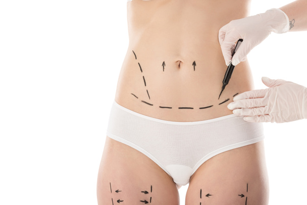 partial view of plastic surgeon in latex gloves making marks on body isolated on white - 写真・画像