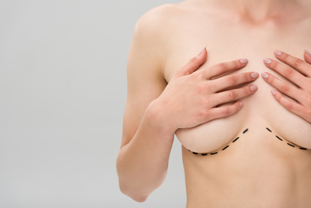 vista parcial de mujer desnuda con marcas bajo el pecho aisladas en gris
 - Foto, Imagen