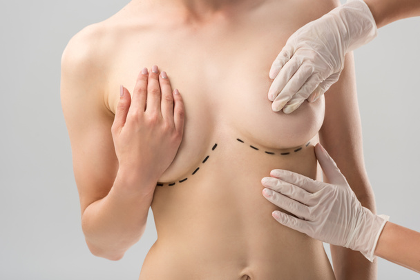 partial view of plastic surgeon in latex gloves and patient with marks under breast isolated on grey - Photo, Image