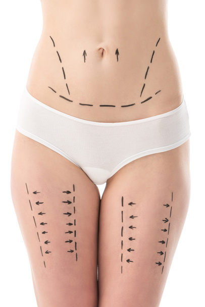 częściowy widok kobiety w majtki z ślady na brzuch i biodra izolowane na białym - Zdjęcie, obraz