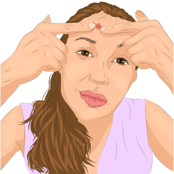 女性の顔にきび問題のイラスト - ベクター画像