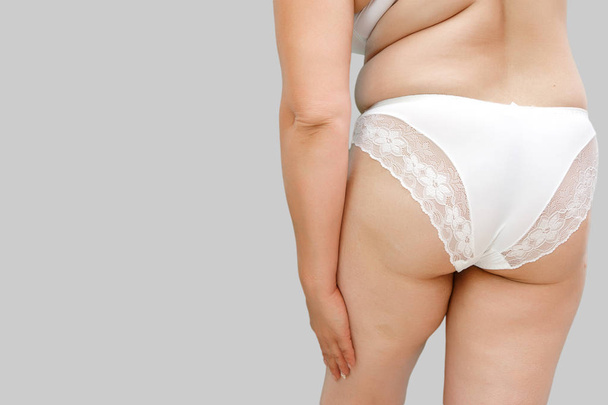 a woman with excess weight applying cream on the buttocks and le - Photo, Image