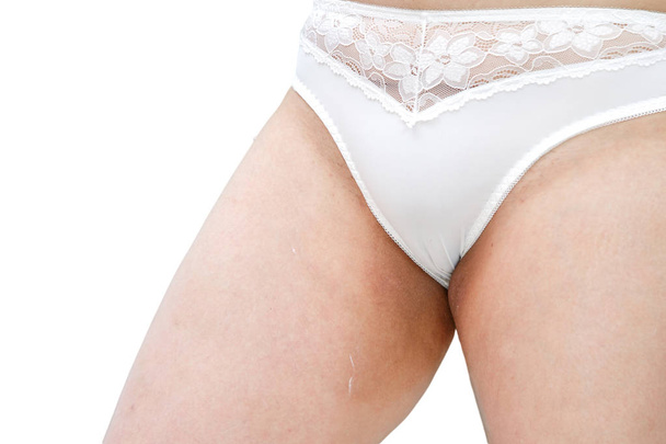 donna in biancheria intima bianca applicare la crema nelle aree di sfregamento
  - Foto, immagini