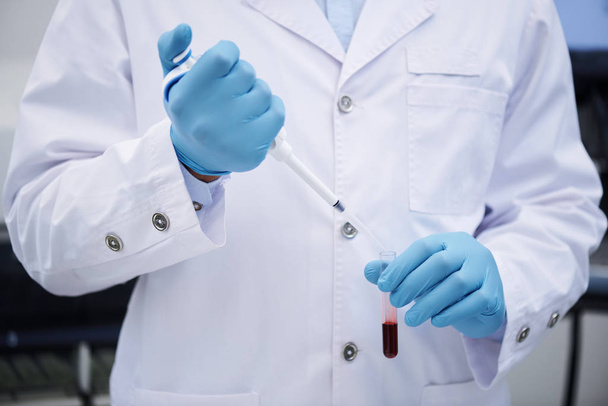 Lähikuva tunnistamaton lääkäri valkoisessa takissa ja kirurgiset käsineet pudottamalla verta koeputkeen, säästää elämän luovutuskeskuksessa käsite
 - Valokuva, kuva