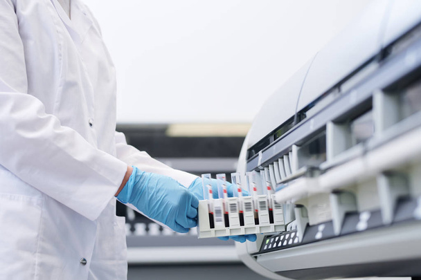 Close-up de técnico de laboratório irreconhecível em casaco branco e luvas estéreis colocando amostras de sangue no misturador de rolos de tubo
 - Foto, Imagem