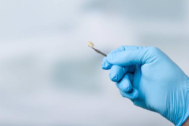 Hammaslääkärin käsi sävy opas tarkistaa viilu hampaita
  - Valokuva, kuva