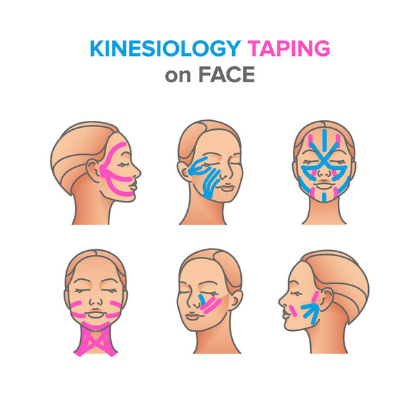 Kinesiologie taping illustraties op gezicht - Vector, afbeelding