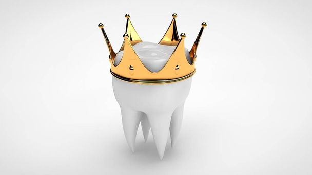 3D απόδοση ενός λευκού ανθρώπινου δοντιού στέφθηκε με ένα χρυσό στέμμα. Η ιδέα της θεραπείας, της αποκατάστασης, της προσθετικής σε μια οδοντιατρική κλινική. εικόνα 3D σε λευκό φόντο, απομονωμένη. - Φωτογραφία, εικόνα