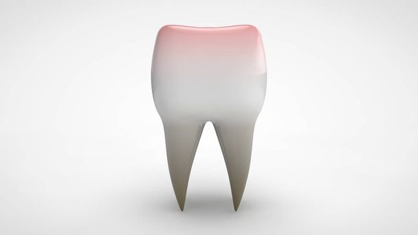 白い背景に隔離された病気の人間の歯の3Dイラスト。歯は赤い、病気の考え、ヘルスケア. - 写真・画像