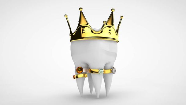 Representación en 3D de un diente humano blanco con una corona de oro y anillos con piedras preciosas. La idea de una vida lujosa, tratamiento caro y de alta calidad, prótesis. Imagen aislada
 - Foto, Imagen
