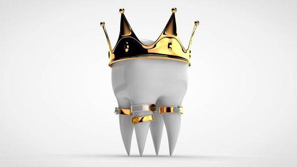 3D rendering of a white human tooth with a gold crown and rings with precious stones. The idea of a luxurious life, expensive and high-quality treatment, prosthetics. Isolated image - Photo, Image