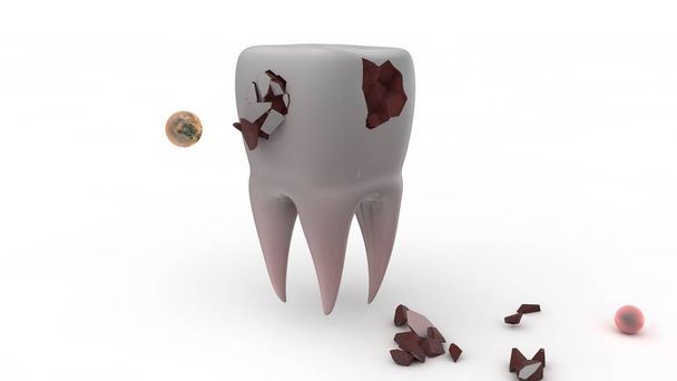Renderização 3D de um dente humano doente, destruído. Ilustração para promover um estilo de vida saudável e cuidados da cavidade oral. Ilustração 3D isolada sobre fundo branco
 - Foto, Imagem