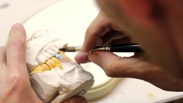 laboratóriumi-fogászati implantátumok. - Felvétel, videó