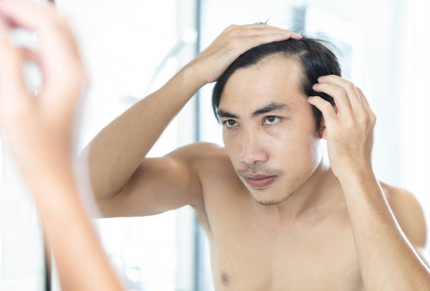 Primer plano hombre mirando reflejo en el espejo grave problema de pérdida de cabello para el cuidado de la salud champú y concepto de producto de belleza
 - Foto, Imagen