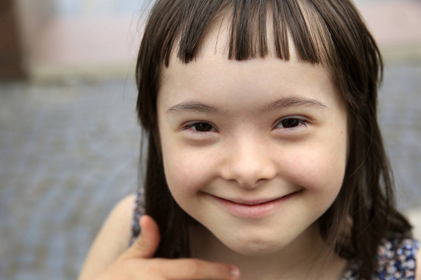 Χαριτωμένο κορίτσι χαμογελαστό σύνδρομο down στο μπλε φόντο - Φωτογραφία, εικόνα