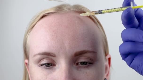 Haarmesotherapie oder Haartransplantation: Ein Kosmetikerin Arzt macht Injektionen in den Kopf einer Frau für Haarwachstum oder zur Verhinderung von Haarausfall - Filmmaterial, Video