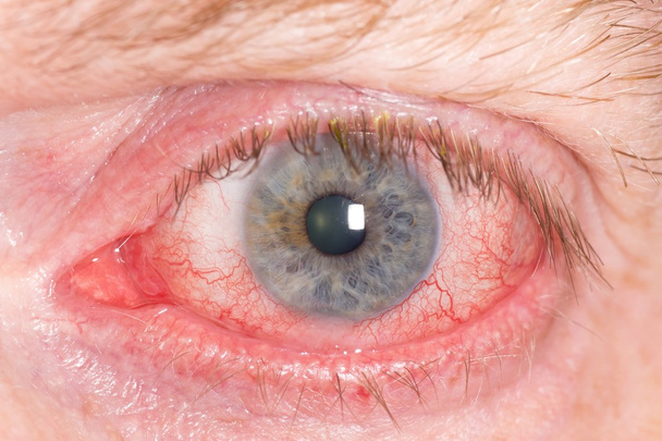 Red human eye - Photo, Image