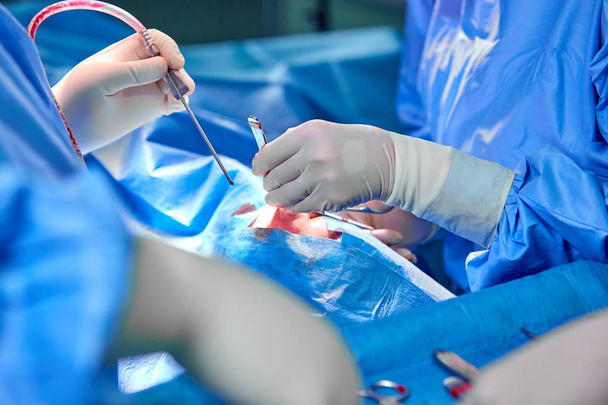Хірург і його асистент виконують косметичну хірургію на носі в операційній кімнаті лікарні. Перетворення носа, розширення. ринопластики
. - Фото, зображення