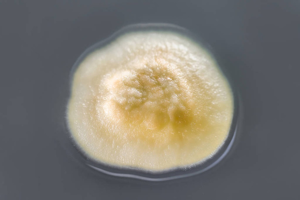 Колония плесени грибка культивируется из воздуха в помещении
 - Фото, изображение