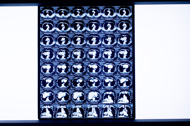 Serie di immagini da tomografia computerizzata del cervello e risonanza magnetica
 - Foto, immagini