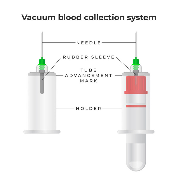 Vakuum-Blutentnahmesystem infografische Elemente. Vakuum-Blutgefäß, doppelseitige Nadel, Nadelhalter - Vektordarstellung in flacher Ausführung. - Vektor, Bild